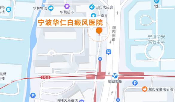宁波华仁白癜风医院路线