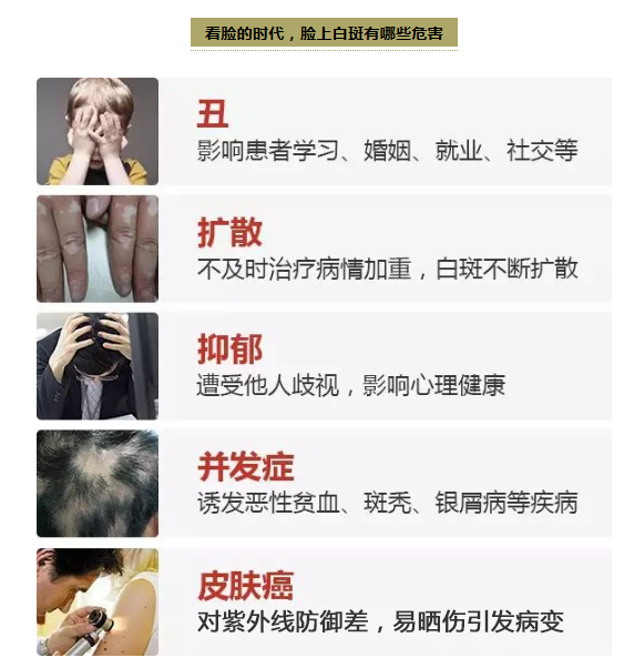 早期白癜风的危害有哪些