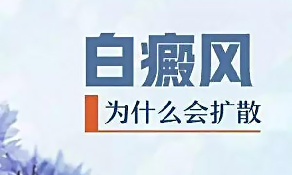 宁波治白癜风