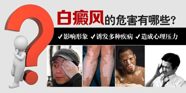 宁波白癜风医院